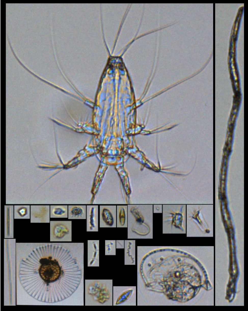 Figure 4: Plankton from the FlowCam images. 
