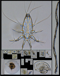 Plankton from the FlowCam images. Photo Credit: NOAA.