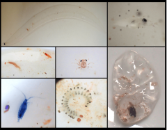 Some of the animals collected across our net tows. Photo Credit: NOAA.